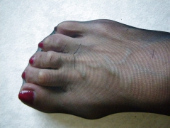 Black feet