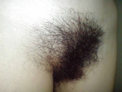 Some hairy girls 2 - N