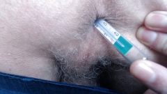 Rectal temp and suppository - N