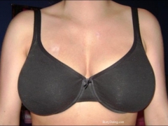 Busty Breast Reductions - Set 15 - N